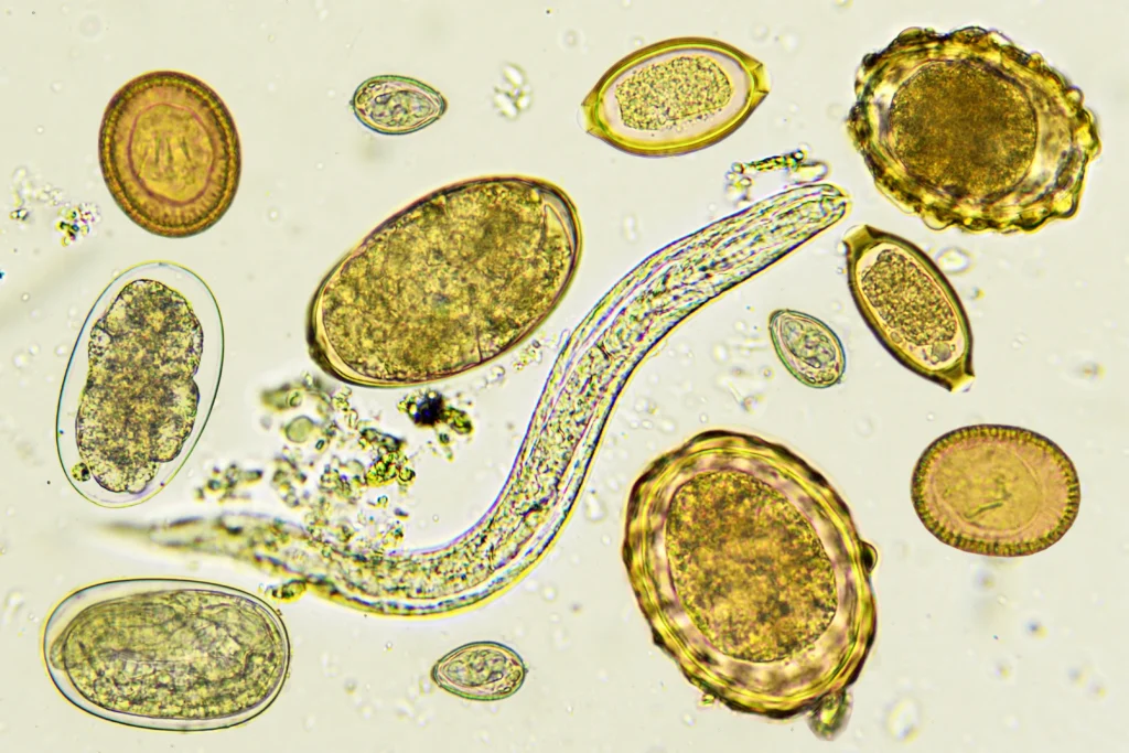 Principais-Tipos-de-Verminoses-Parasitoses-Sintomas-Tratamentos